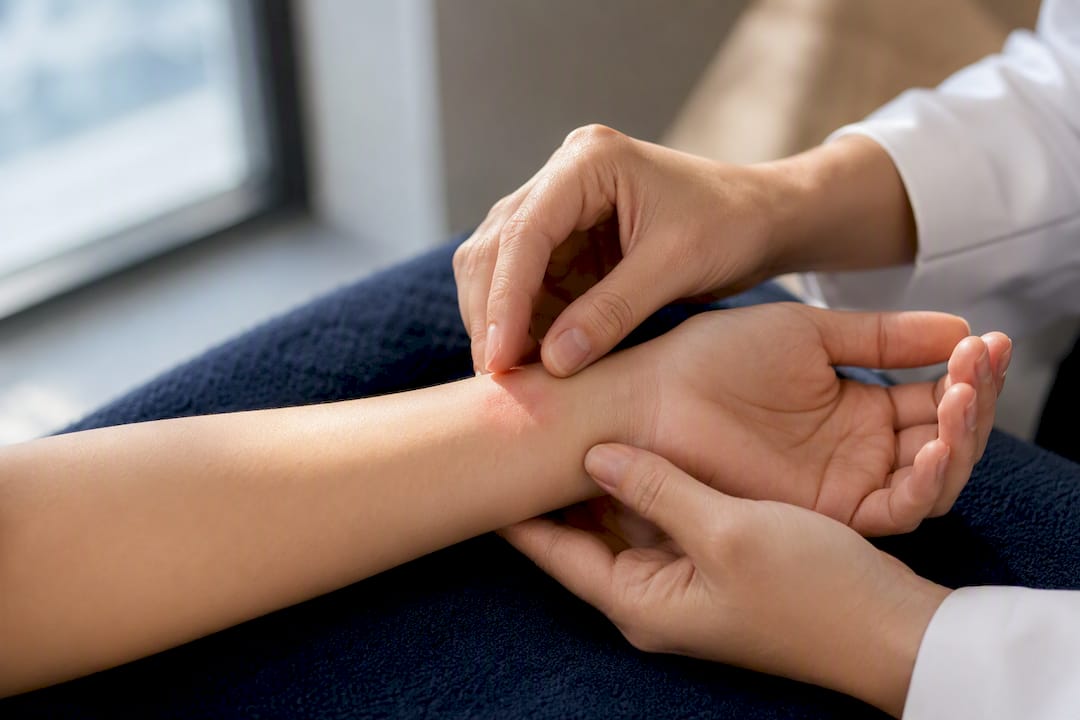 Clinician examining a patch-test redness area